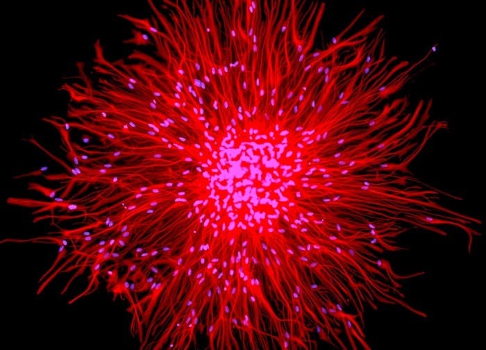 What Are You Feeding Your Neurons?