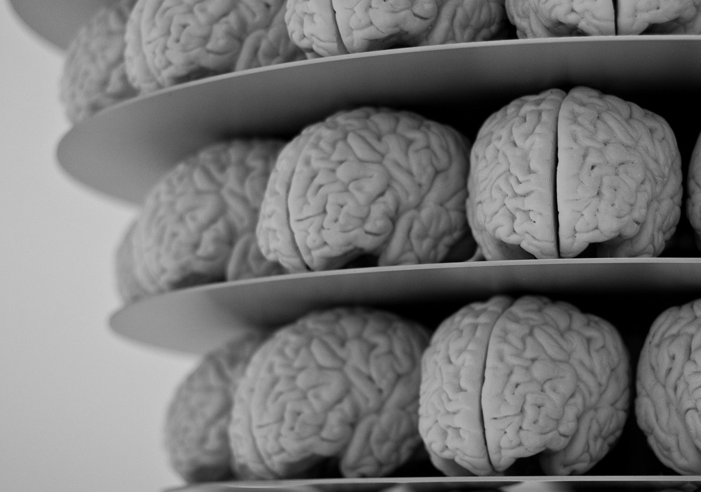 5 Things You Might Not Know About Neurosculpting® By: Megan Winkler